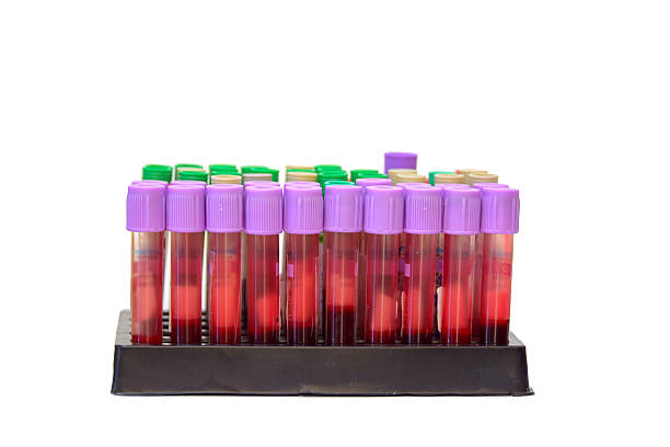istock Blood tubes , Blood In tube for laboratory analysis 512134481
