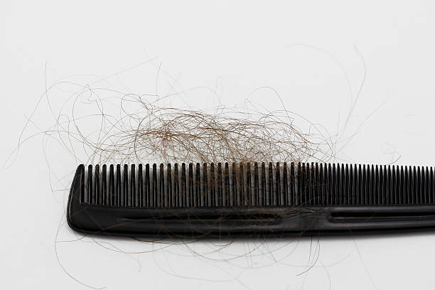 Comb hair loss stock photo