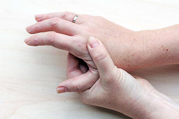 sore hands sore hands of a woman wart stock pictures, royalty-free photos & images