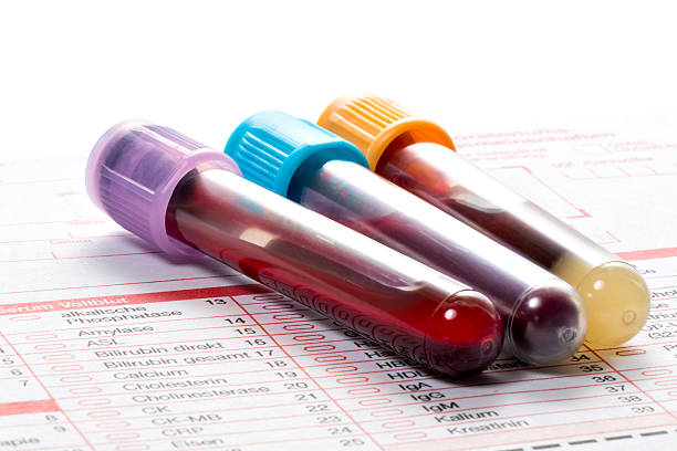 血液検査、血液のサンプルで検査フォーム - blood red blood cell blood cell blood sample ストックフォトと画像