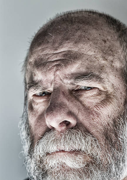 istock Squinting Flaky Skin Senior Man Skeptical Close-up Face Portrait 512459238