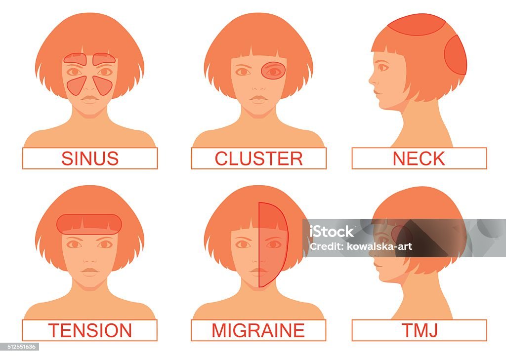 type of headache pain, type of headache pain, different head pain illustration Headache stock vector
