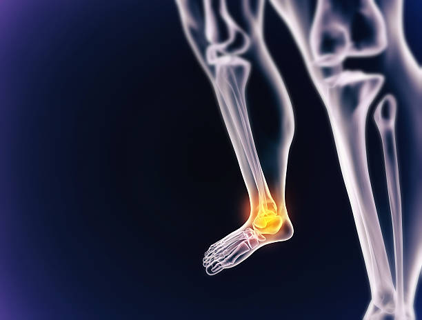 istock Facing the pain of inflammation 512605449