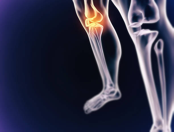 istock The pain of inflammation 512605467