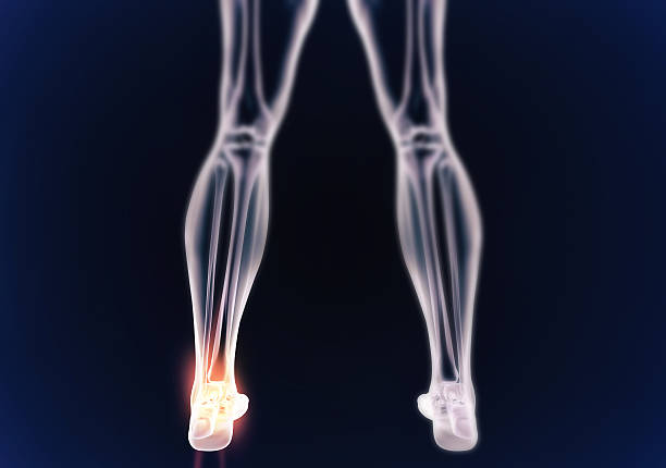 istock Facing the pain of inflammation 512623647