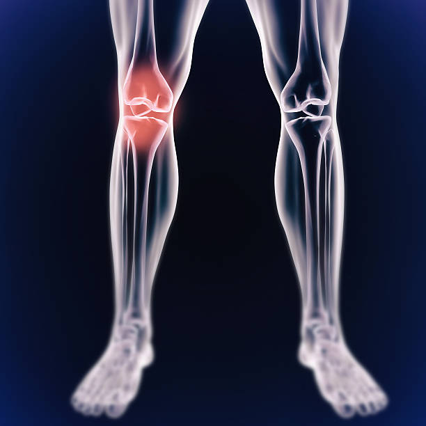 patrzeć do kolana - x ray human knee orthopedic equipment human bone zdjęcia i obrazy z banku zdjęć