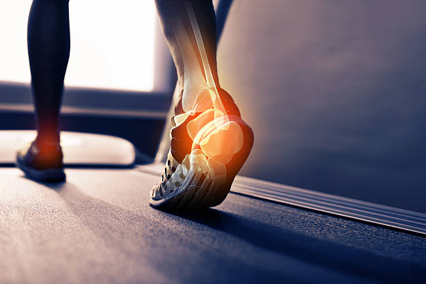 Run off your heels Rear view shot of the highlighted joints in a runner's foot treadmill photos stock pictures, royalty-free photos & images