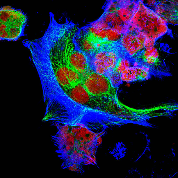 neuroblastoma cells - stem cell human cell animal cell science 뉴스 사진 이미지