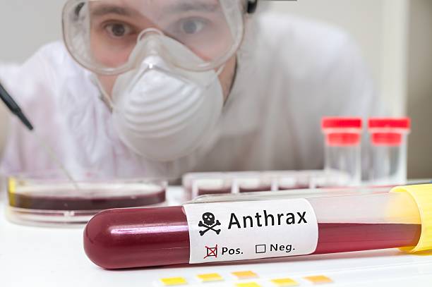 Scientist is analyting blood sample for Anthrax. stock photo