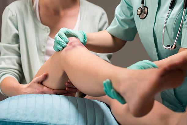 istock Woman with knee contusion 512885324