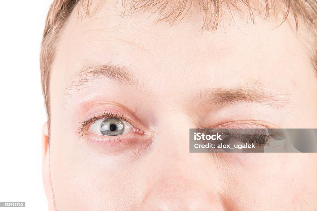 Man's tired eyes Man's tired gray eyes, clean skin Adult Stock Photo