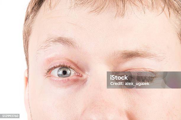 Mans Tired Eyes Stock Photo - Download Image Now - Adult, Blinking, Blue