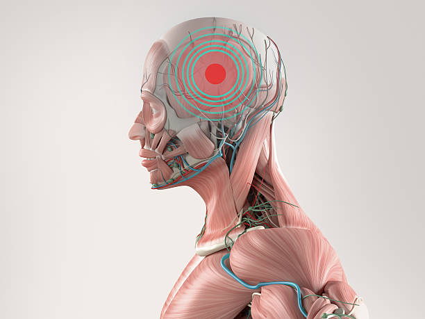 istock Anatomy model showing a headache. 513105844