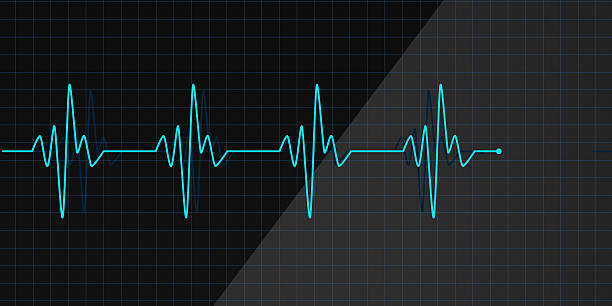 istock Lifeline in an electrocardiogram 513204507