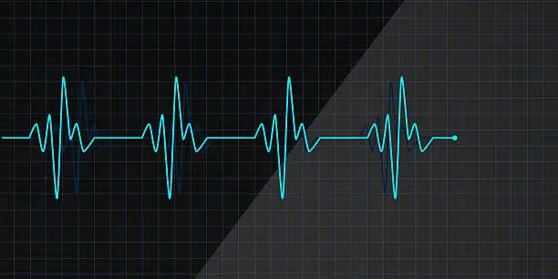 Lifeline in an electrocardiogram