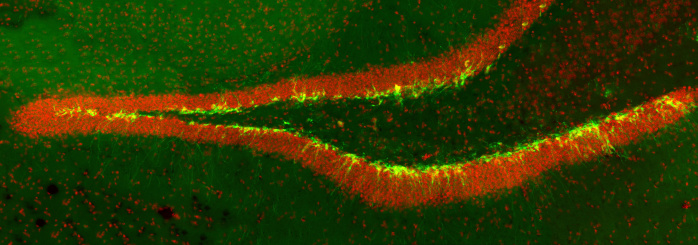 New born neurons in the transgenic mouse hippocampus (dentate gyrus) labeled with green fluorescent marker