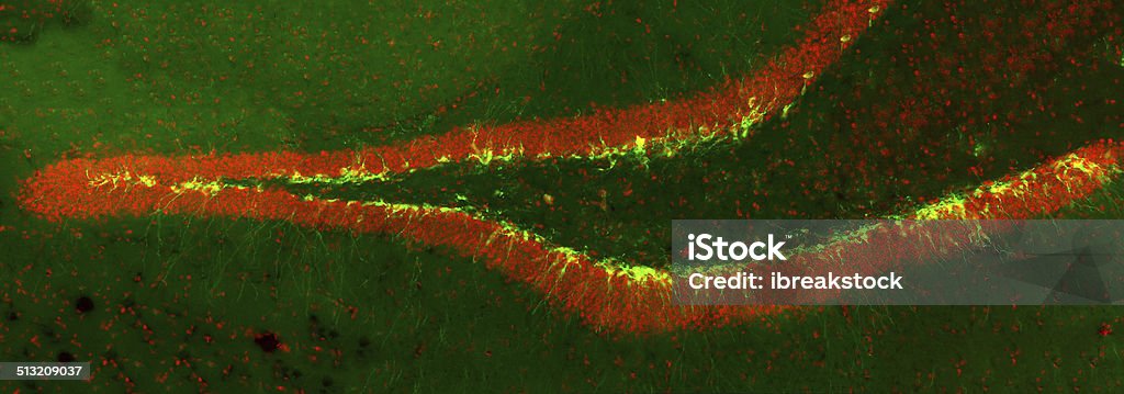 New born neurons in the transgenic mouse hippocampus New born neurons in the transgenic mouse hippocampus (dentate gyrus) labeled with green fluorescent marker Biological Cell Stock Photo
