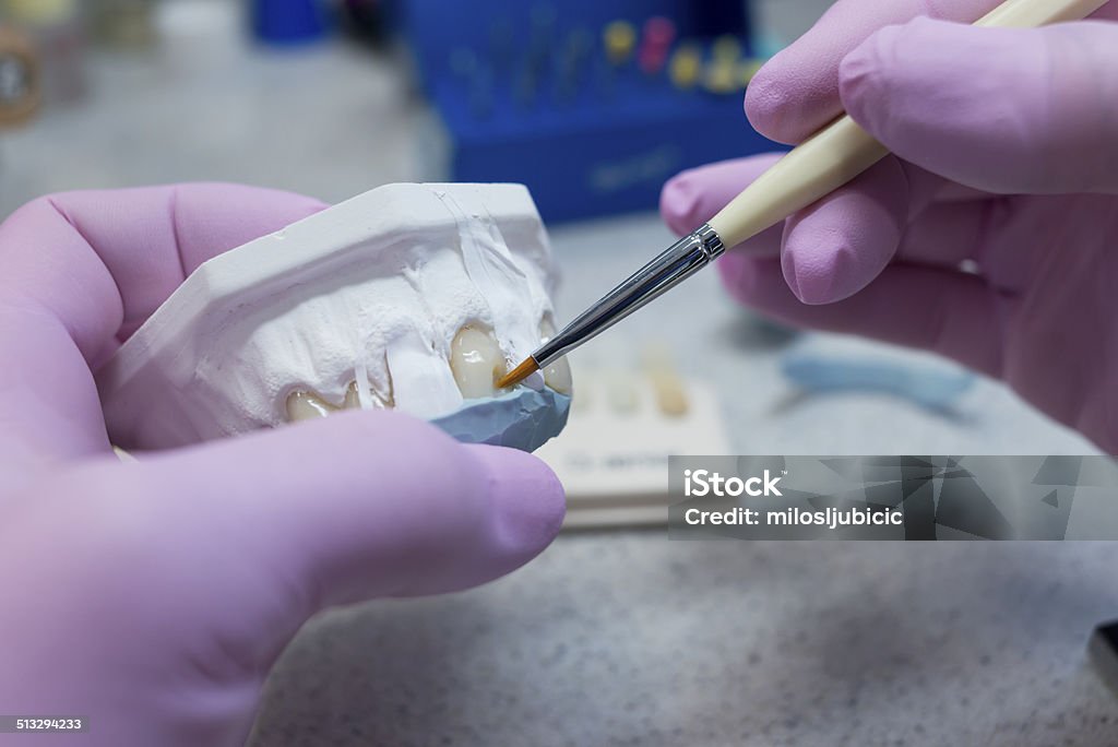 Dental Hand of dentist holding dental gypsum models Technician Stock Photo