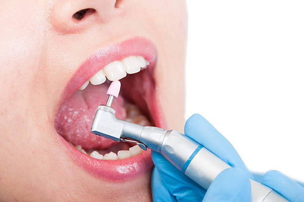 istock Dentist ussing pink polishing stone to remove plaque from teeth 513380820