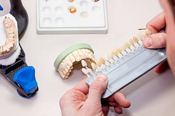 Falso dientes en blanco en la tabla. - foto de stock