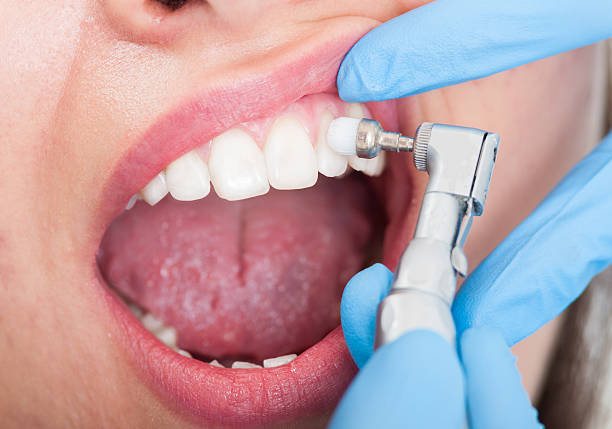 istock Closeup of female patient having teeth examination 513475984