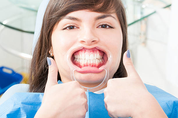 istock Attractive female patient wearing retractor and thumb up 513476252