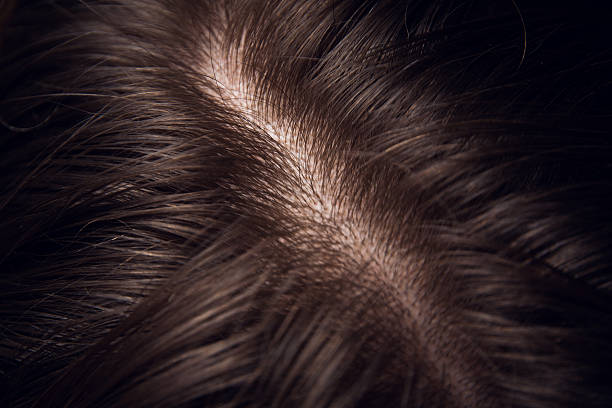 hair and head skin close up
