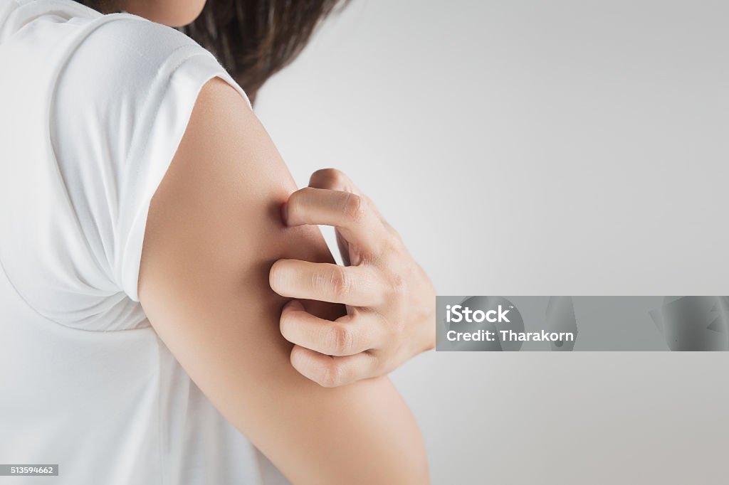 itching Woman scratching her arm. Scratching Stock Photo