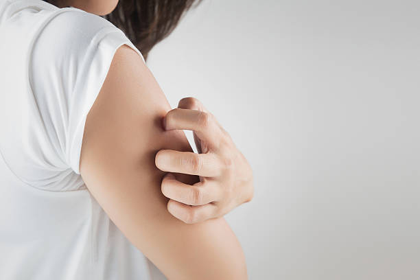 itching Woman scratching her arm. dermatitis photos stock pictures, royalty-free photos & images