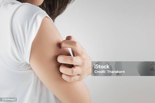 Itching Stock Photo - Download Image Now - Scratching, Allergy, Mosquito