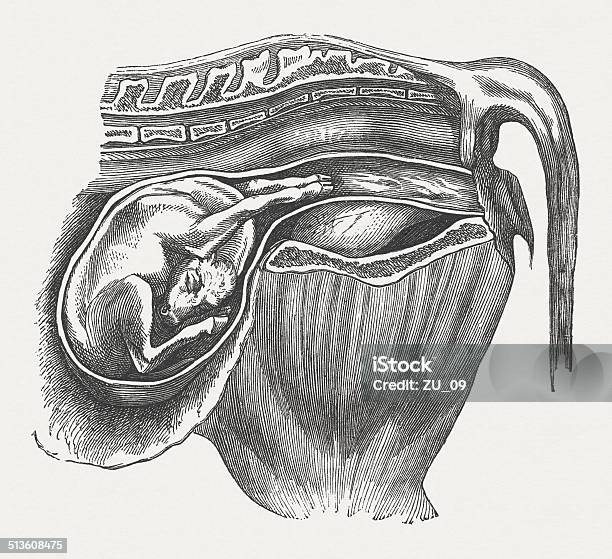 Cow Fetus Abnormal Position Bent Downward Head Published 1883 Stock Illustration - Download Image Now