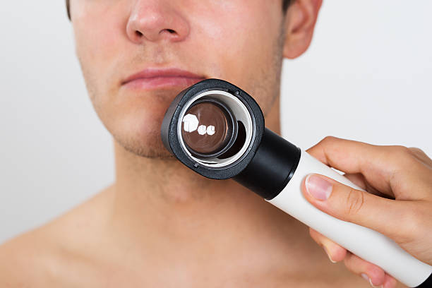 istock Person Hands Checking Man Face With Dermatoscope 513627316