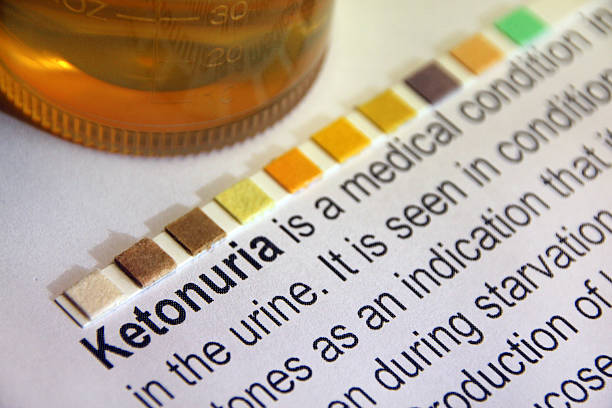 The 10 Best Ways to Measure Your Ketone Levels and Monitor Your Progress in Ketosis 3 ketone urine test