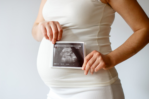 Pregnant woman holding an untrasound scan of her baby