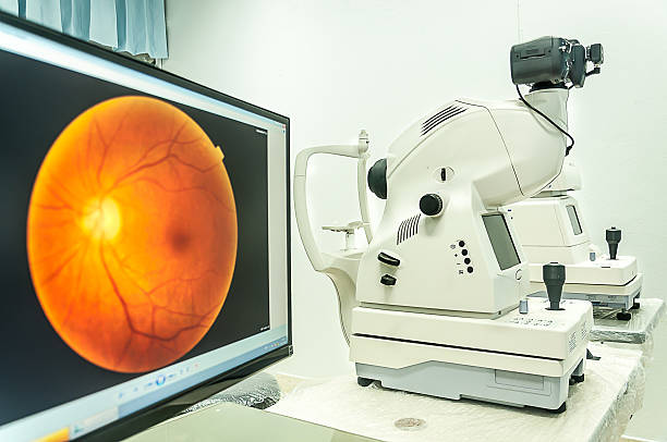 fond de œil caméra utiliser pour examen œil à l'hôpital - animal retina photos et images de collection