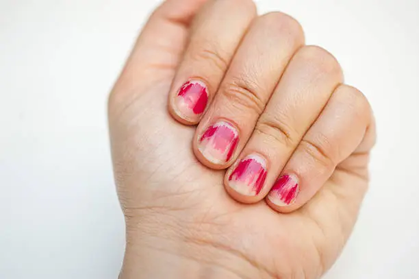 Female fingers with with chapped nail polish