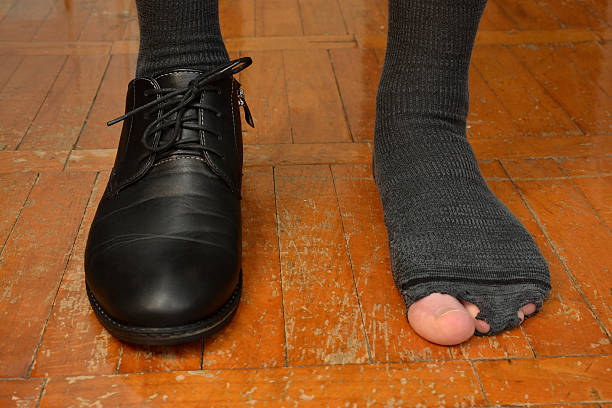 istock male feet in one Shoe and torn sock 514410218