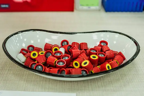 Photo of Cap tubes of blood sampling in a laboratory