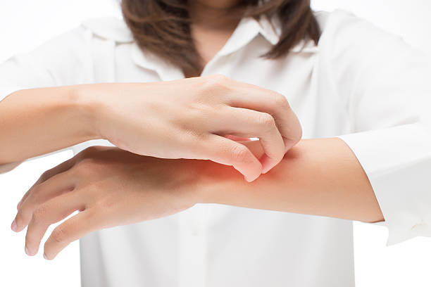 istock Women scratch the itch with hand 514425904