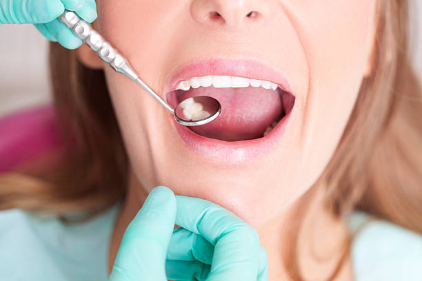 Patient visiting dentist Female patient with open mouth  receiving dental inspection at dentist's office dental cavity photos stock pictures, royalty-free photos & images
