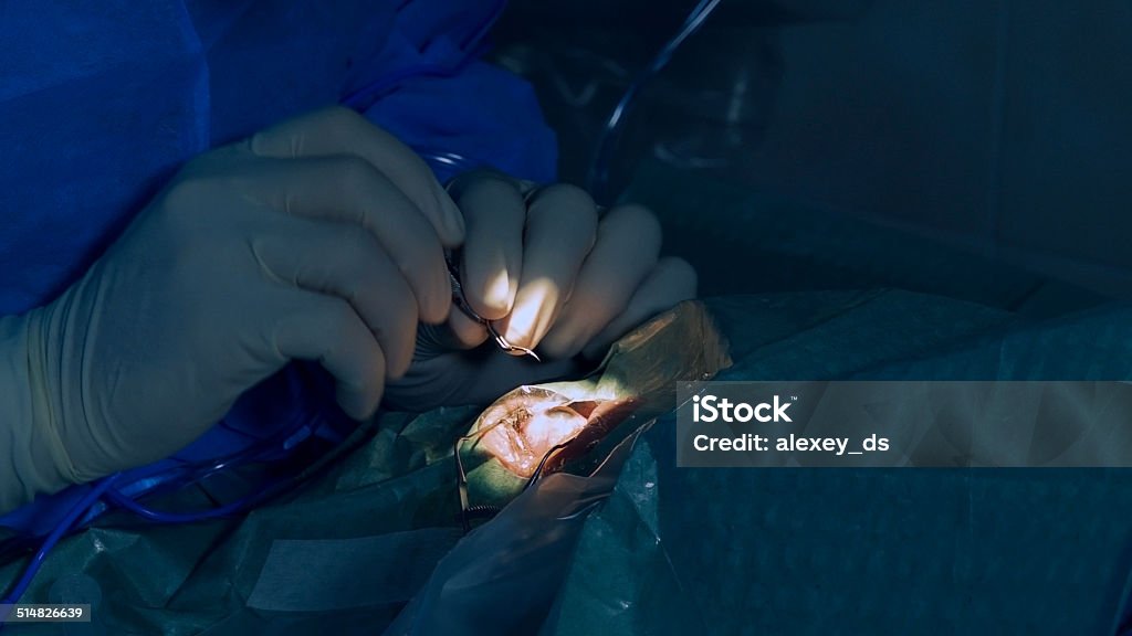 Eye microsurgery. Medical operation Blue Stock Photo