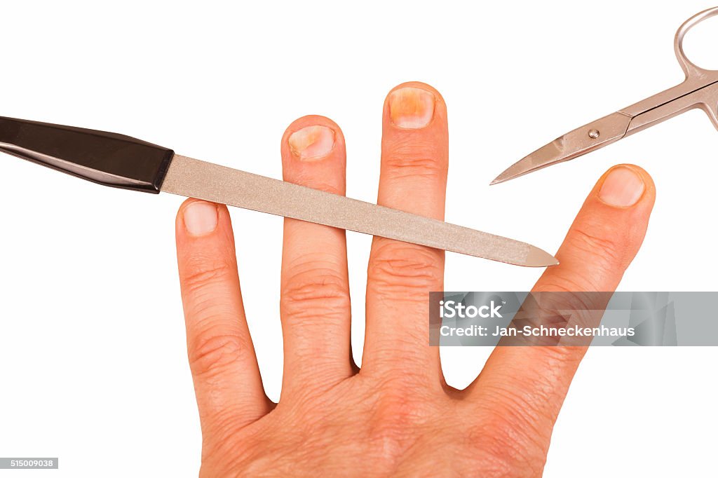 Fingernails with nail fungus Cuticle Stock Photo