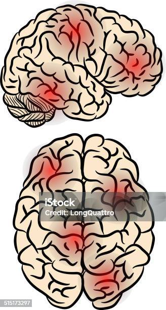 Brain Fever Stock Illustration - Download Image Now - Anatomy, Anxiety, Biology