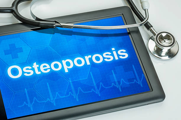 istock Tablet with the text Osteoporosis on the display 515225692