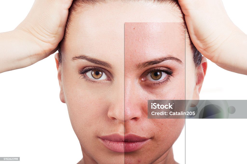 Flawless woman portrait before and after facial correction Flawless woman portrait before and after facial correction as skincare and beauty treatment concept against white background In Front Of Stock Photo