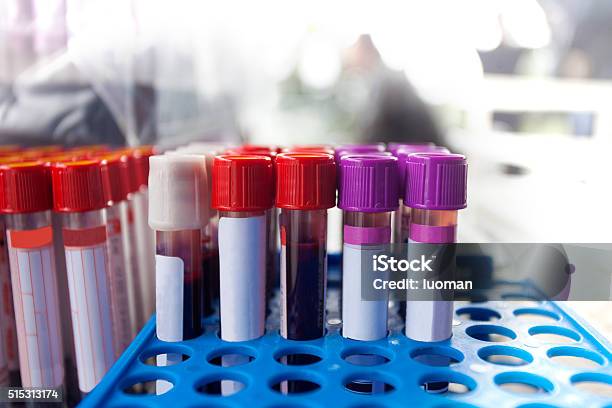 Blood Test Sample Stock Photo - Download Image Now - Blood Test, Test Tube, Blood