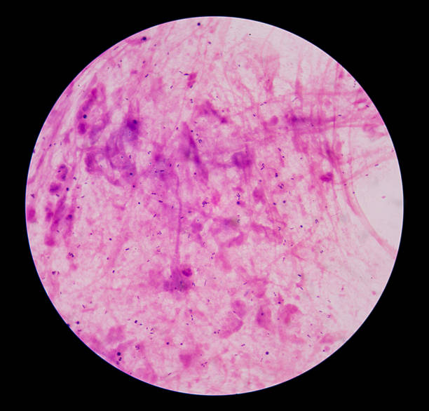 istock gram stain test showing bacteria cells. 515317370