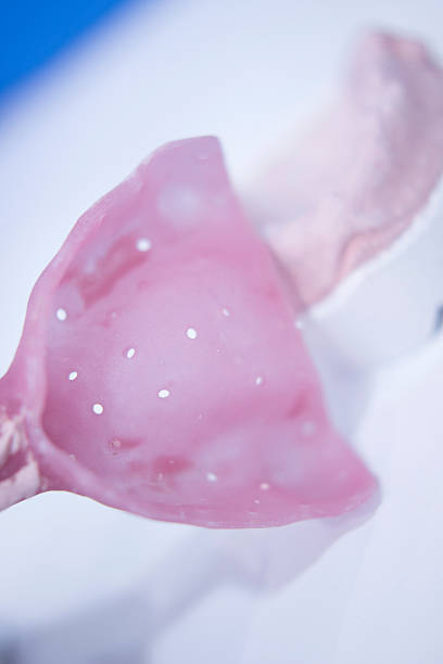 istock Dental mold dental impression plate 515435346