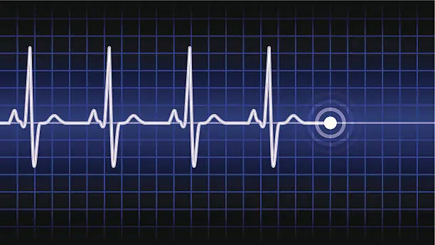 Vector illustration of Heart Beat