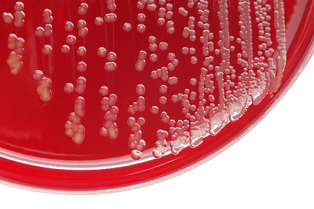 staphylococcus áureo colonias de bacterias que en una placa de agar sangre - staphylococcus petri dish bacterium biology fotografías e imágenes de stock